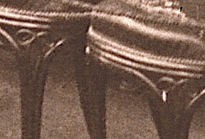 Primera versión det 2